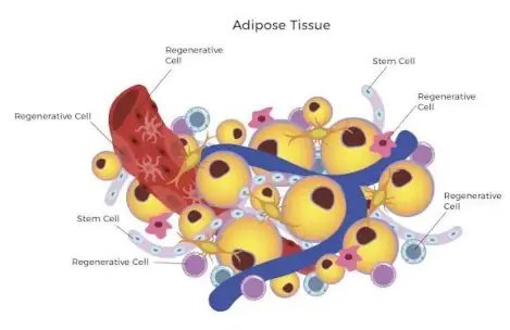Adipose (Fat) Tissue + PRP